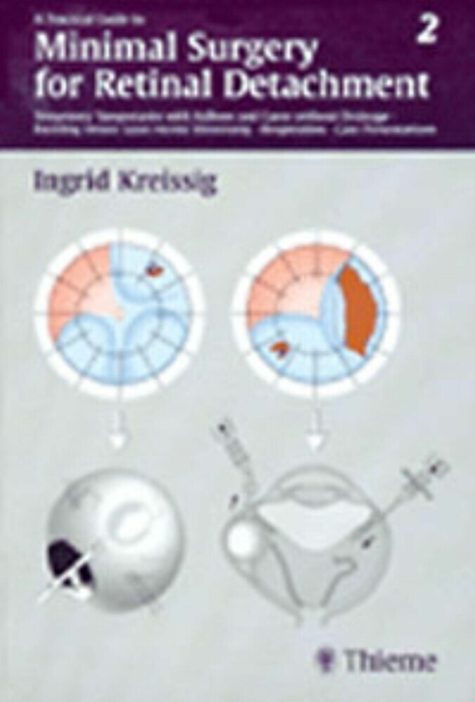 A Practical Guide to Minimal Surgery for Retinal Detachment, Vol. 2