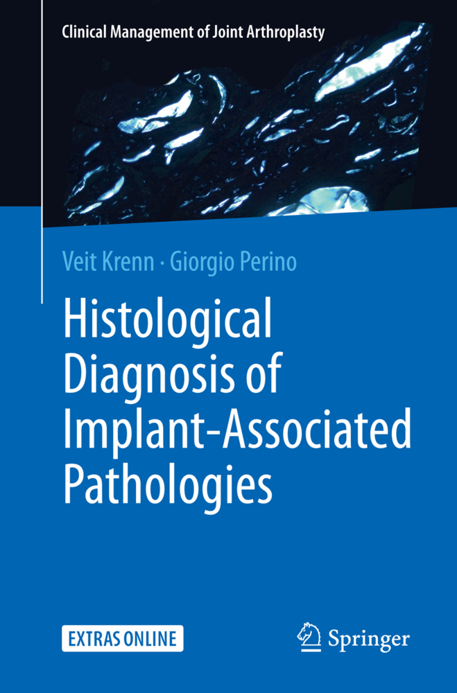 Histological Diagnosis of Implant-associated Pathologies