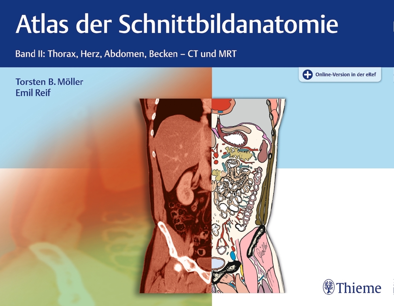 Atlas der Schnittbildanatomie. Bd.2