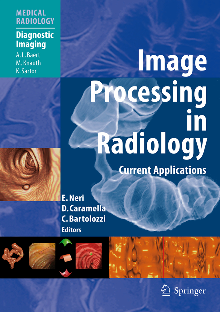 Image Processing in Radiology