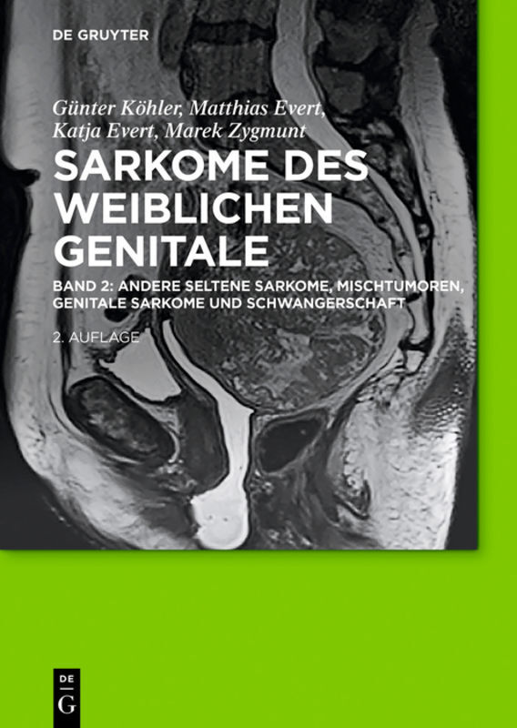 Andere seltene Sarkome, Mischtumoren, genitale Sarkome und Schwangerschaft. Bd.2