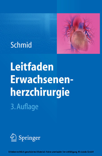 Leitfaden Erwachsenenherzchirurgie