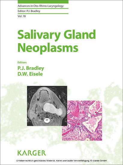 Salivary Gland Neoplasms