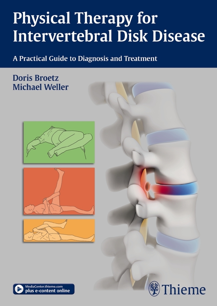 Physical Therapy for Intervertebral Disk Disease