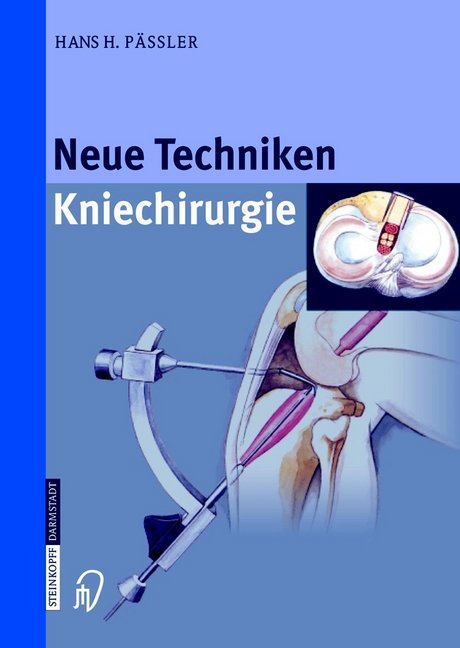 Neue Techniken Kniechirurgie