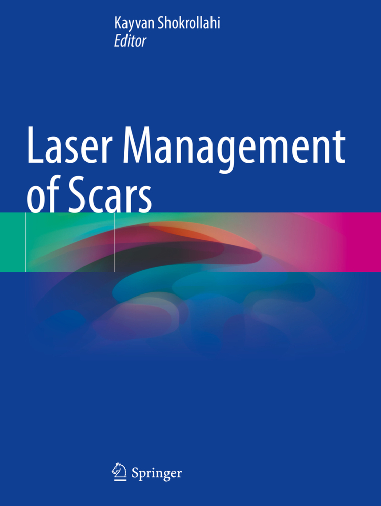 Laser Management of Scars