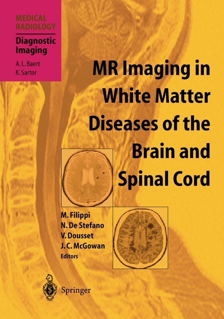 MR Imaging in White Matter Diseases of the Brain and Spinal Cord