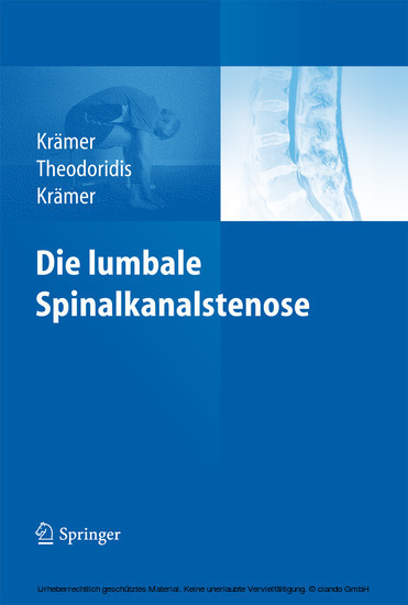 Die lumbale Spinalkanalstenose