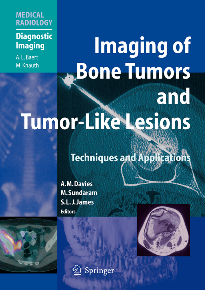 Imaging of Bone Tumors and Tumor-Like Lesions