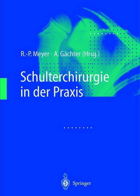 Schulterchirurgie in der Praxis