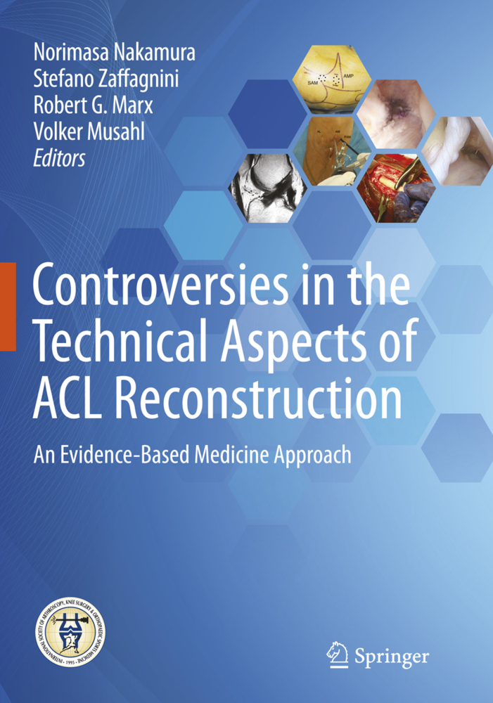 Controversies in the Technical Aspects of ACL Reconstruction