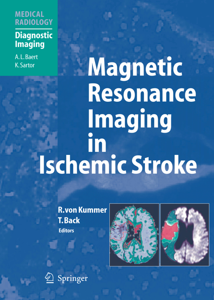 Magnetic Resonance Imaging in Ischemic Stroke