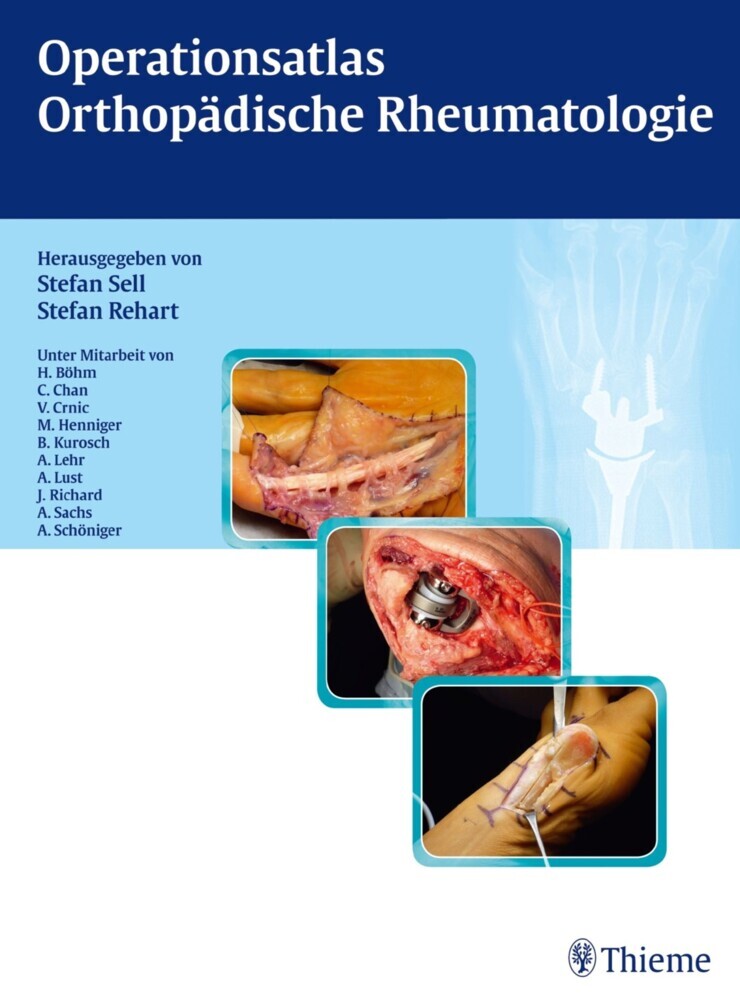 Operationsatlas Orthopädische Rheumatologie