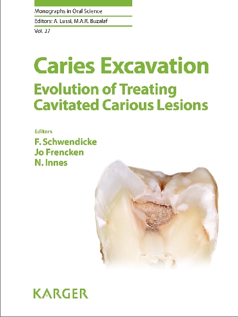 Caries Excavation: Evolution of Treating Cavitated Carious Lesions