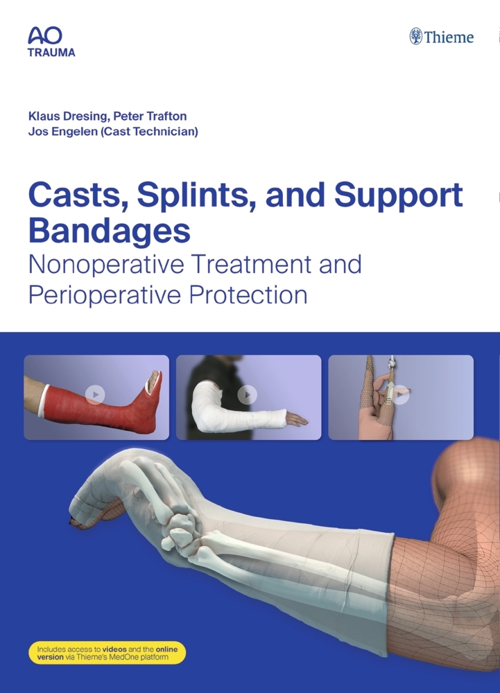 Casts, Splints, and Support Bandages