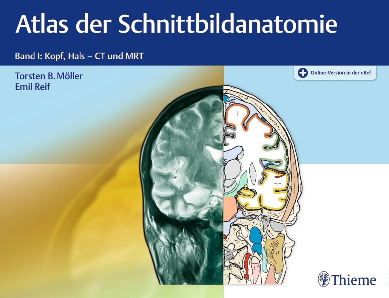 Atlas der Schnittbildanatomie. Bd.1