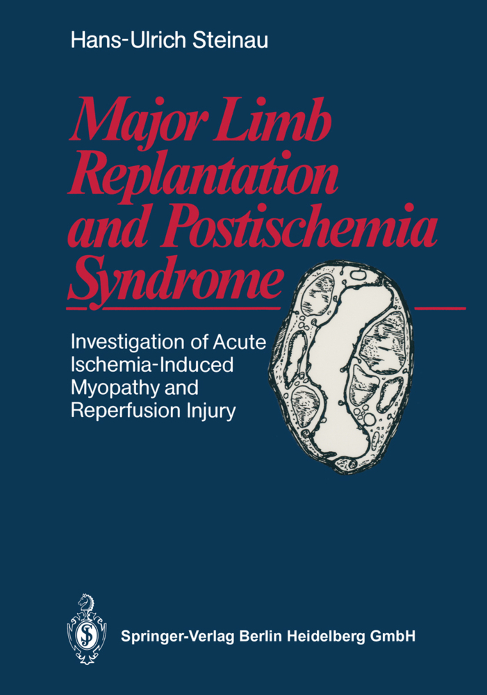 Major Limb Replantation and Postischemia Syndrome
