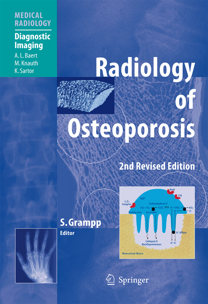 Radiology of Osteoporosis