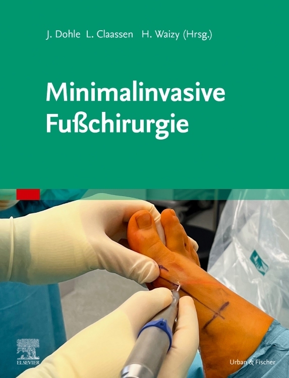 Minimalinvasive Fußchirurgie