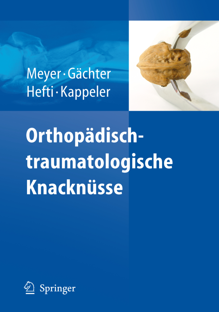 Orthopädisch-traumatologische Knacknüsse