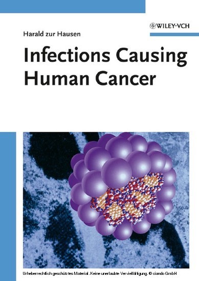 Infections Causing Human Cancer
