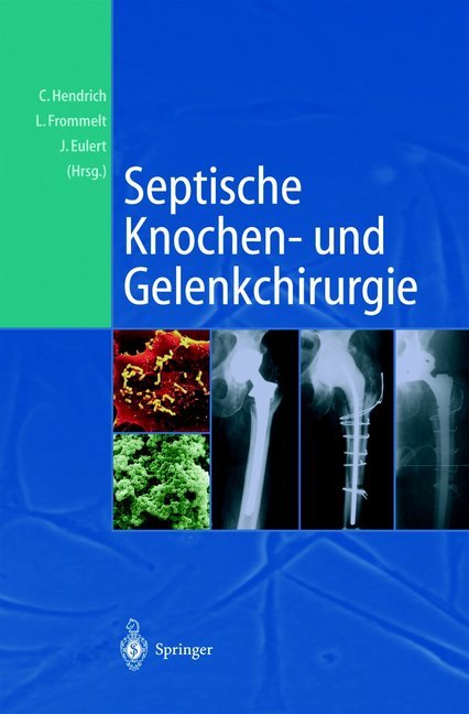 Septische Knochen-und Gelenkchirurgie