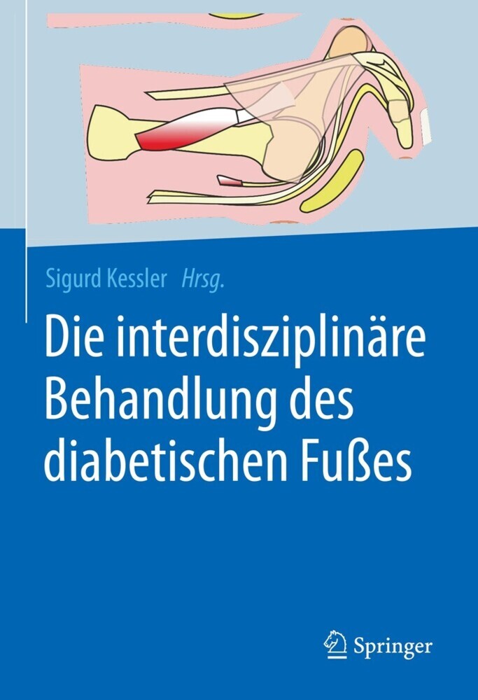 Die interdisziplinäre Behandlung des diabetischen Fußes