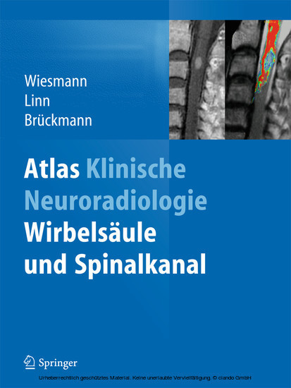 Atlas Klinische Neuroradiologie