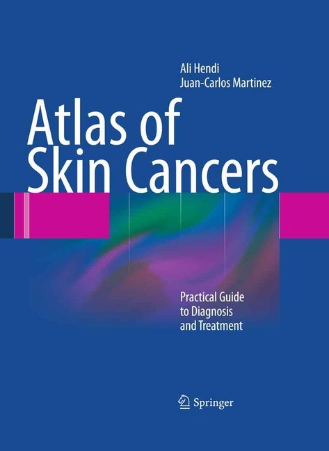 Atlas of Skin Cancers