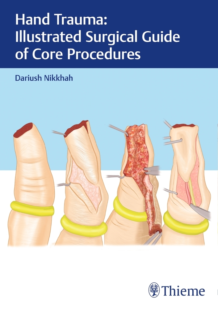 Hand Trauma: Illustrated Surgical Guide of Core Procedures