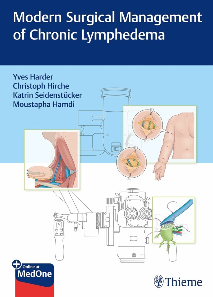 Modern Surgical Management of Chronic Lymphedema