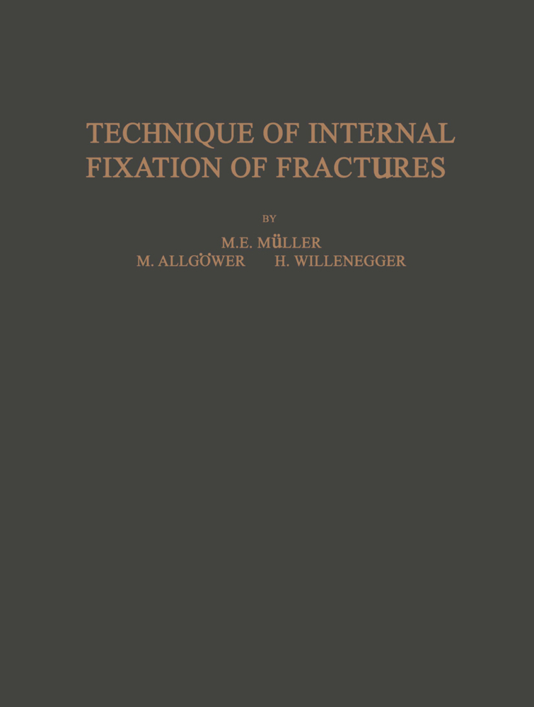 Technique of Internal Fixation of Fractures