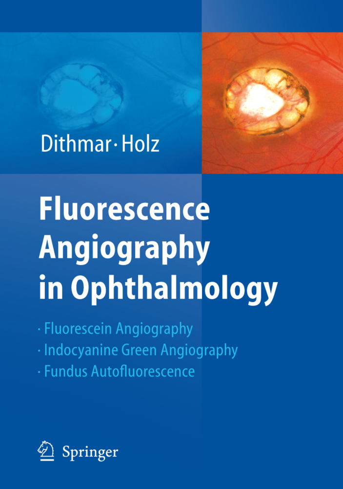 Fluorescence Angiography in Ophthalmology