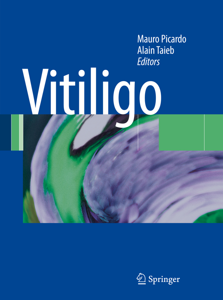Vitiligo