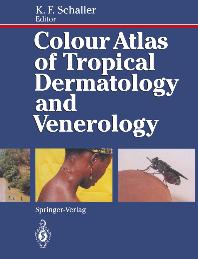 Colour Atlas of Tropical Dermatology and Venerology