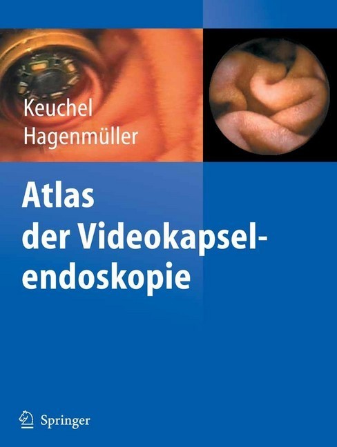 Atlas der Videokapselendoskopie