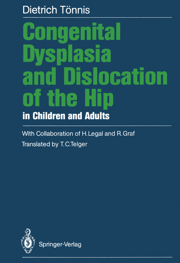 Congenital Dysplasia and Dislocation of the Hip in Children and Adults