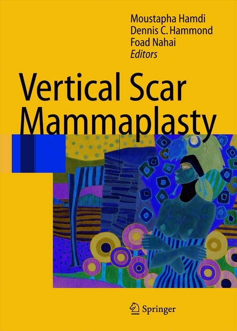 Vertical Scar Mammaplasty