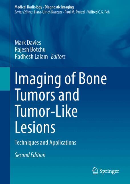 Imaging of Bone Tumors and Tumor-Like Lesions