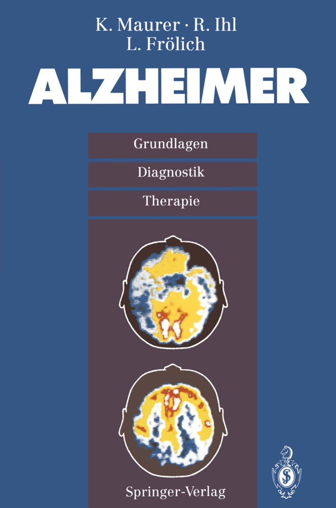 Alzheimer