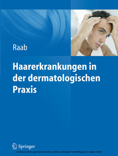 Haarerkrankungen in der dermatologischen Praxis