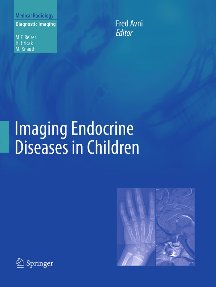 Imaging Endocrine Diseases in Children