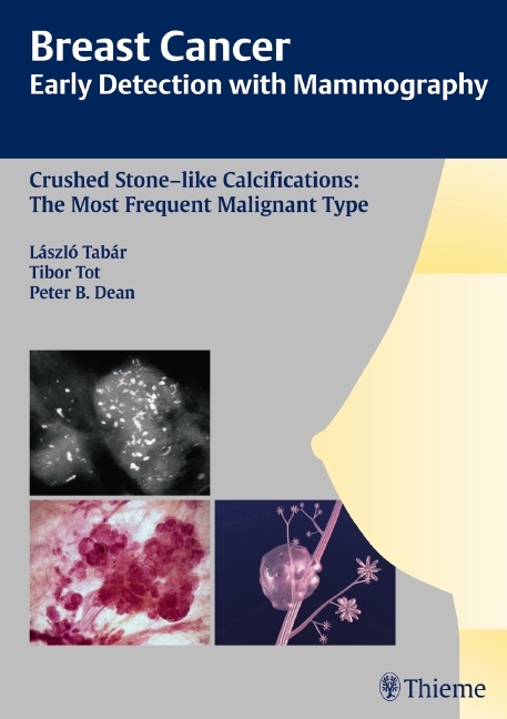 Early Detection with Mammography
