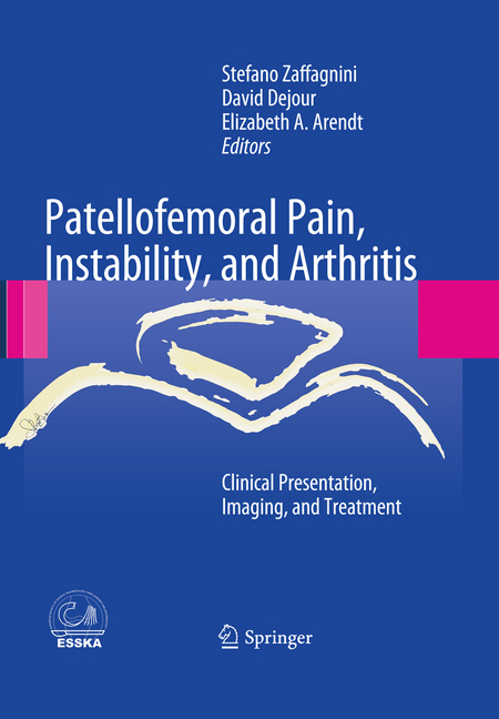 Patellofemoral Pain, Instability, and Arthritis