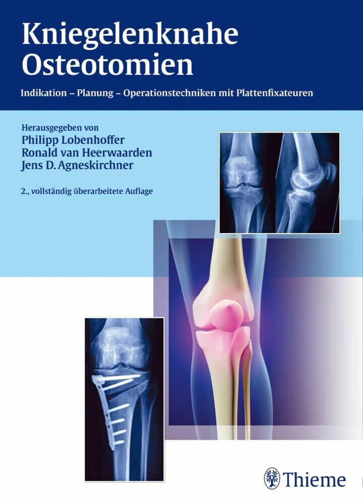 Kniegelenknahe Osteotomien