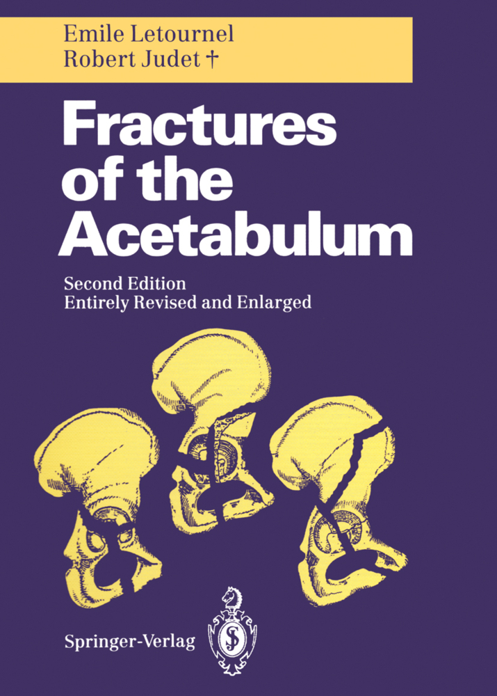 Fractures of the Acetabulum