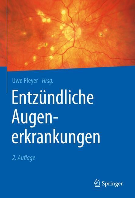 Entzündliche Augenerkrankungen