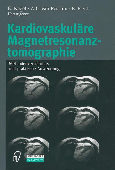 Kardiovaskuläre Magnetresonanztomographie