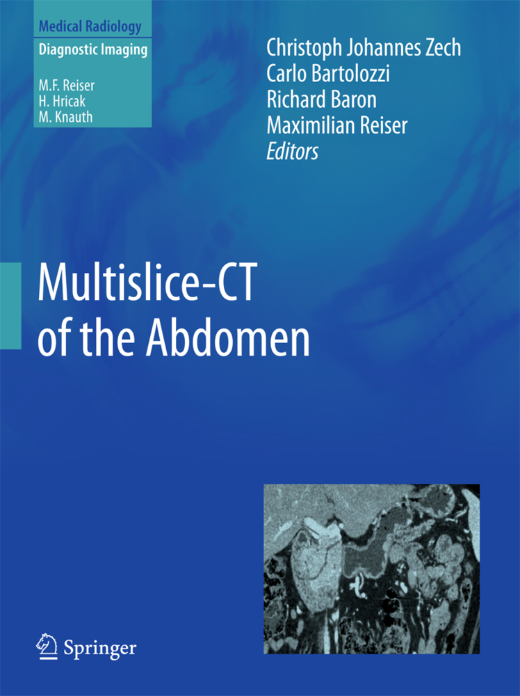 Multislice-CT of the Abdomen