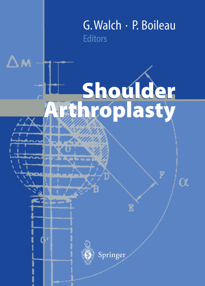 Shoulder Arthroplasty